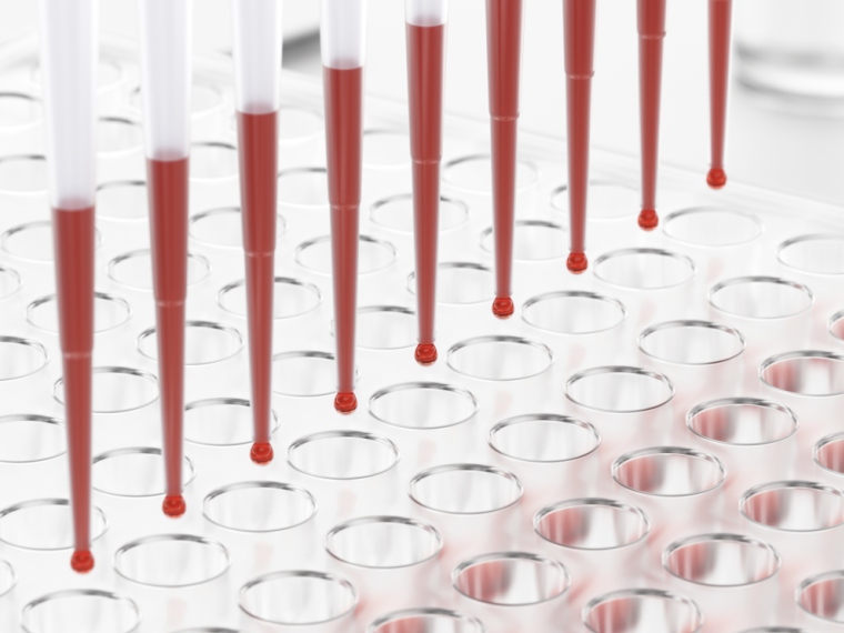 Milyen vérképeltérések esetén érdemes hematológushoz fordulnunk?